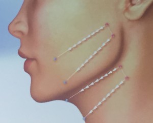 Hilos .FullSizeRender-4